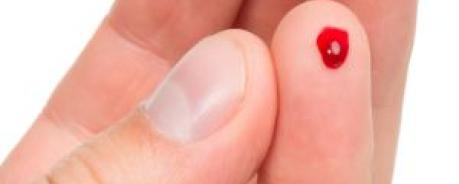 Selbsttest hiv